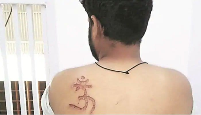 Muslim Inmate tortured in an Indian prison & marked with a Hindu symbol