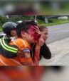 teen blinded by police brutality following peaceful protest