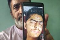 Kashmiri teen dies of pellet, tear gas shell wounds