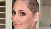 ricki lake hair loss battle