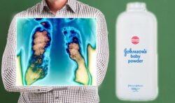 Johnson & Johnson sets aside almost  billion for talc verdict