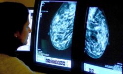 Women under 35 face higher risk of breast cancer spreading – study