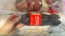 baby was born smaller than a Coke bottle in Christmas!