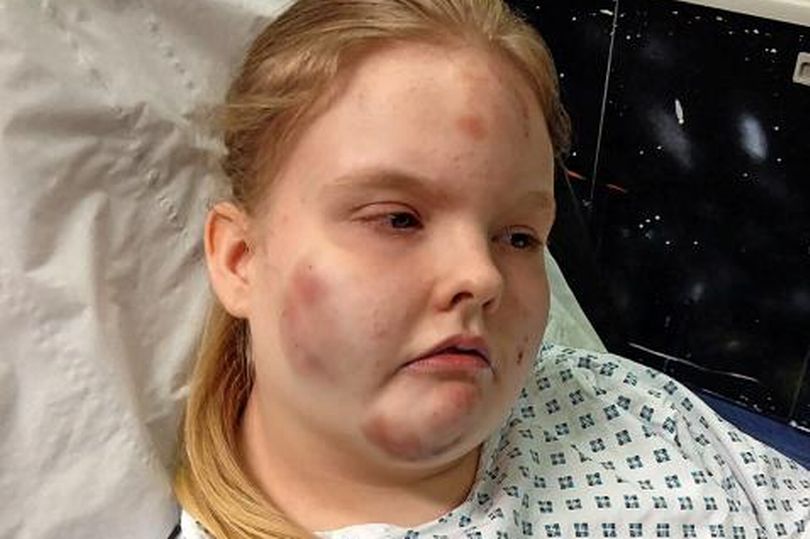 Scots schoolgirl left with horrific injuries after being restrained by teachers in classroom