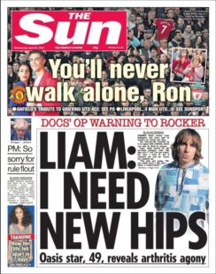 The Sun – Liam: I need new hips