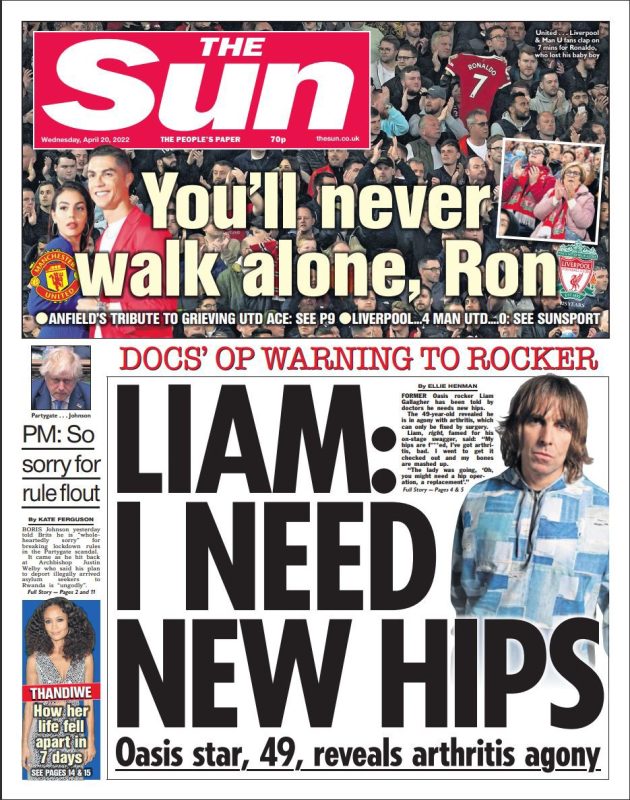 The Sun - Liam: I need new hips
