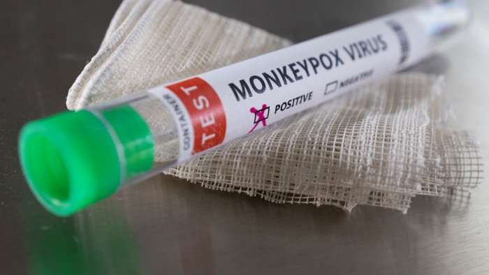 UAE announces first case of monkeypox