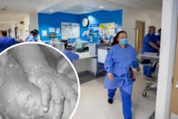Monkeypox outbreak ‘was likely sparked by sex at two raves in Spain and Belgium’