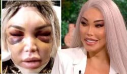 Jessica Alves : This Morning backlash as Twitter trolls attack guest Jessica Alves over £1m surgery