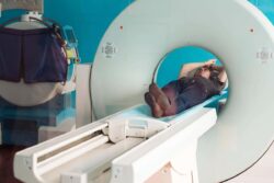 Study highlights concern over ‘missed’ pancreatic cancer in scans