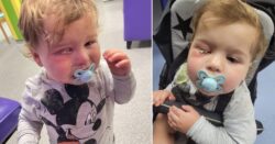 Toddler’s eyes glued shut when nursery worker did nails while holding him