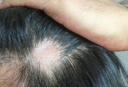 Baldness cure a step closer after scientists grow hair in a lab