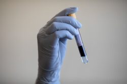 GPs sound the alarm over ‘over-the-counter, unregulated blood tests’