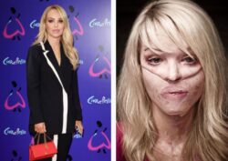 Katie Piper’s acid attacker flees UK sparking global hunt as new pic released