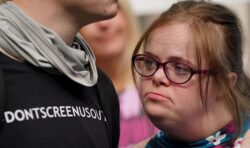 Wife with Down’s Syndrome loses appeal to stop abortions on unborn babies with condition