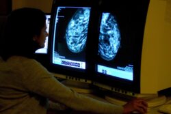 Drug offers lifeline to 1,600 women with rare aggressive form of breast cancer