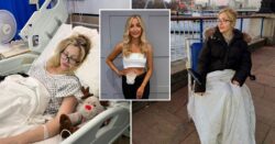 Woman who had rectum and colon removed now loves showing off her stoma bag