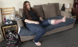 Woman begs doctors to amputate her leg after she was mauled in dog attack