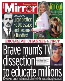 Daily Mirror – Brave mum’s TV dissection to educate millions 