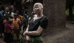 Malawi urged to investigate ‘horrific’ killing of three year old girl with Albinism