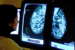 ‘Prescribe exercise to improve lives of breast cancer patients’ – study