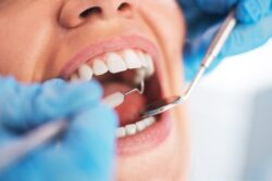 What can you do if you can’t afford the dentist?