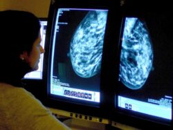 Cancer doctors warn of ‘watershed’ moment for services after 8,000 excess deaths