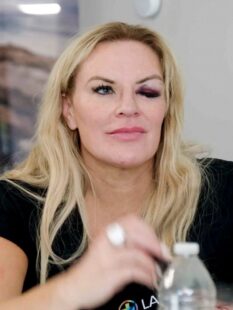 Real Housewives of Salt Lake City star Heather Gay remains tight-lipped over bizarre black eye: ‘It’s privileged information’