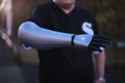 Man receives £9,500 bionic arm after shooting himself as a child