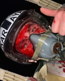 Hero Ukrainian pilot’s gory selfie after ejecting mid-air during drone battle