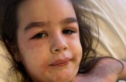 Mum shares Strep A warning signs after daughter left unable to walk