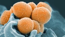 Strep A outbreak – latest: Fourth child dies from bacterial infection as cases rise