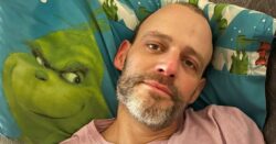 Man loses half his penis after his cancer was misdiagnosed three times