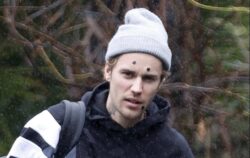 Justin Bieber is really making these £11.99 pimple patches a thing