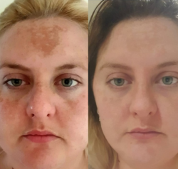 ‘My confidence has grown so much’: Impressive before and after photos show dramatic difference after using ‘amazing’ retinol kit