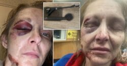 Woman nearly lost her eye after she crashed her £180 e-scooter