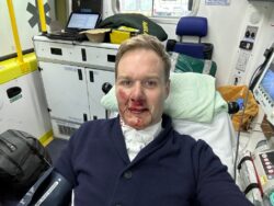 Dan Walker ‘can’t sleep’ after being struck by car in gruesome bike accident