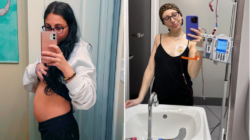 i had a cancerous cyst with skin hair and teeth so big it was like i was pregnant tRWj39 - WTX News Breaking News, fashion & Culture from around the World - Daily News Briefings -Finance, Business, Politics & Sports News