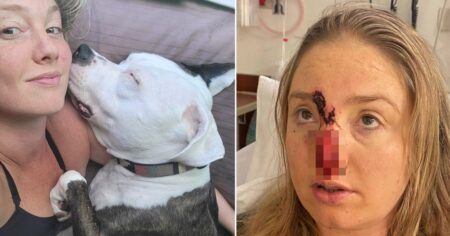 Dog bit woman’s nose off ‘because it was startled by her teeth whitening light’