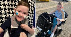 Boy ‘allergic to the sun’ can’t go outside after six organ transplants
