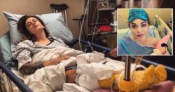 Woman almost loses both her legs after falling asleep drunk