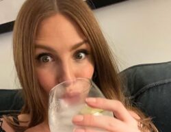 Millie Mackintosh reveals results of lip fillers as she speaks transparently about getting ‘tweakments’
