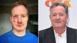 Piers Morgan accuses Dan Walker of ‘milking’ horror bike accident – and Twitter is appalled