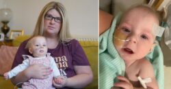 Baby with rare genetic condition ‘in five-month wait for NHS operation’