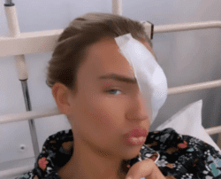TOWIE star Ella Rae Wise’s eye paralysed after stressful surgery to remove lump