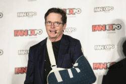 Michael J Fox nearly lost a finger and ‘broke’ his face while living with Parkinson’s