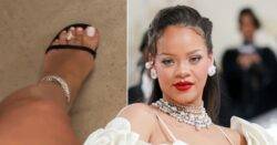 Rihanna has the biggest diamond toe ring we’ve ever seen, of course