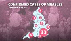 London records most measles cases amid ‘concerning’ rise