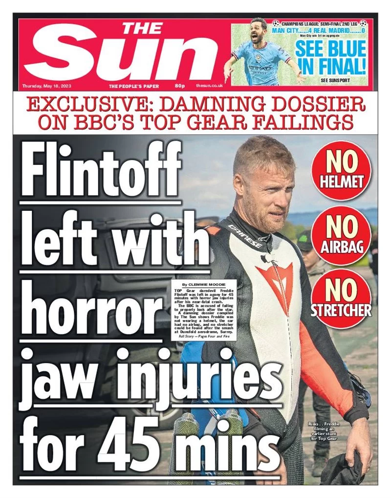 The Sun - Flintoff left with horror jaw injuries for 45mins
