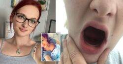Mum who lost all her teeth to pregnancy sickness ’embraces’ new look